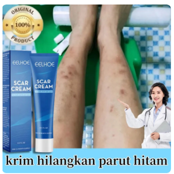 Salep penghilang bekas luka Penghilang bekas luka hitam koreng Penghilang bekas luka di kaki Penghil