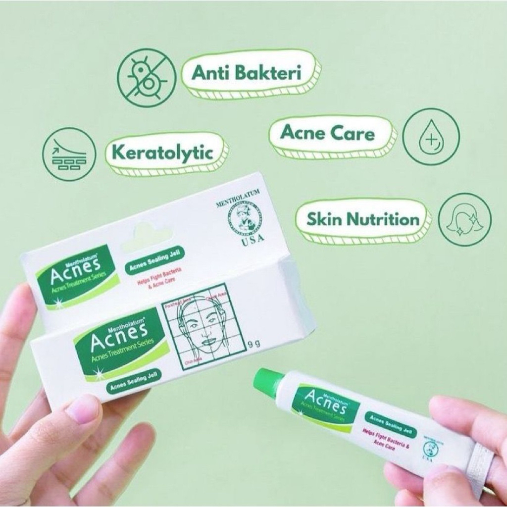 (BPOM) ACNES SEALING JELL 9gram - CREAM JERAWAT - SALEP ACNE ACNES SEALING GEL JERAWAT