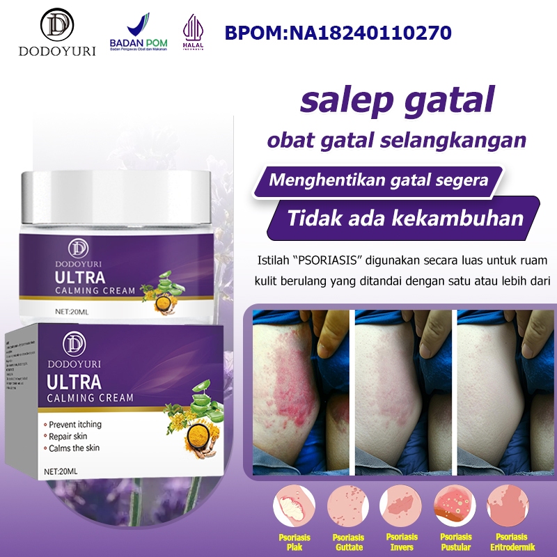 Obat gatal selangkangan Obat panu Salep gatal Obat kurap 30g Obat gatel Obat eksim Obat gatal gatal 