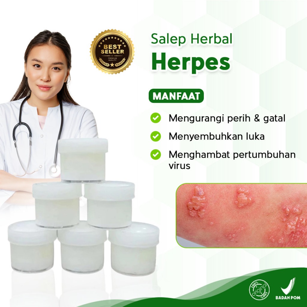 Salep Herpes Topcer Serbaguna Paling Ampuh Salep Herpes Kulit Alami Salep Ajaib