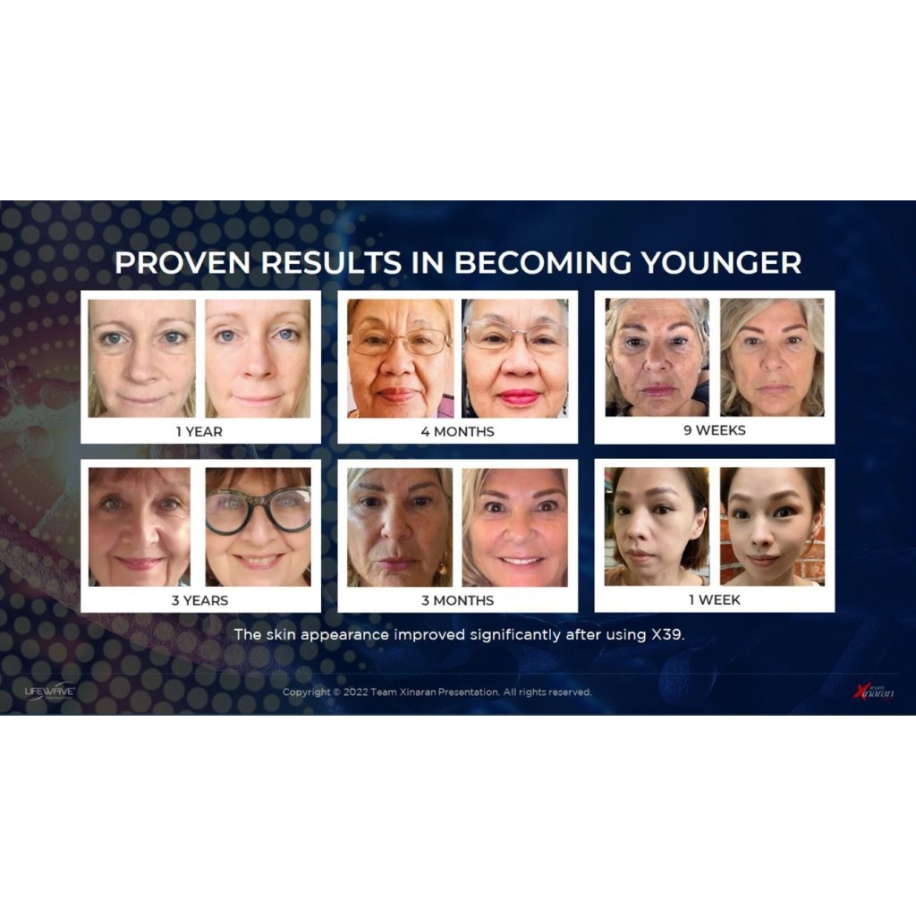 Lifewave X39 30pcs - Mau Awet Muda Tanpa Suntikan? Lifewave Patch X39 Jawabannya - tanpa suntikan, t
