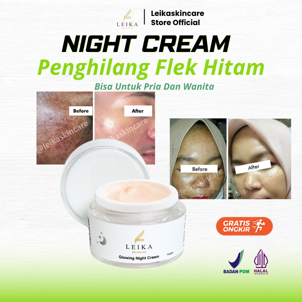 cream flek hitam membandel salep flek hitam membandel menghilangkan flek hitam di wajah pemutih waja