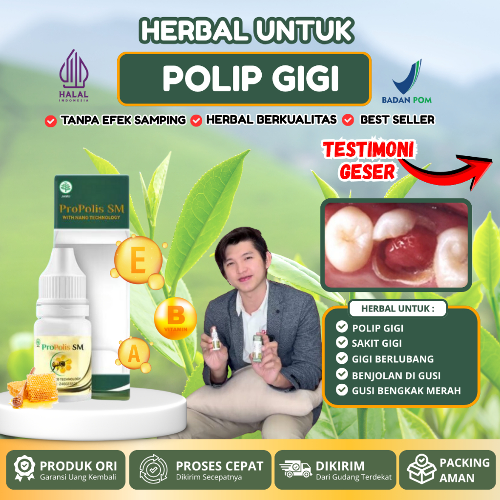Propolis SM - Obat Polip gigi, Obat Gusi Bengkak, Obat Gusi berdarah, Obat Benjolan gigi, Obat Gigi 