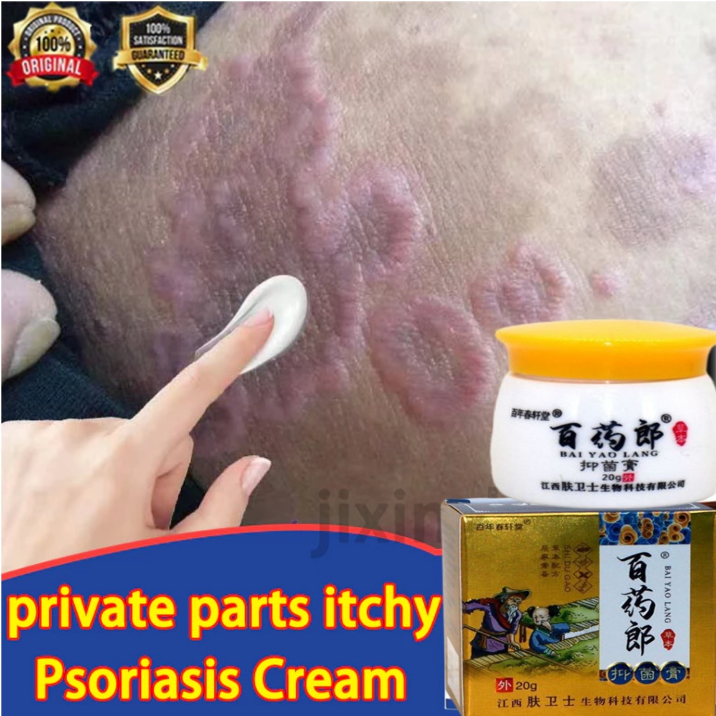 Salep Gatal Paling Ampuh Anti Jamur Gatal Gatal Seluruh Badan Obat Gatal Kulit Salep Eksim Gatal Sal