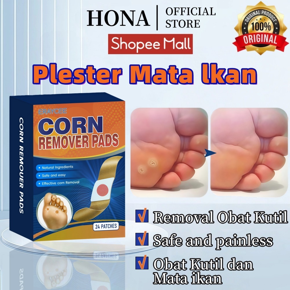HONA - Plester Mata Ikan Plester Obat Kutil Foot Corn Removal Penutup Kutil Obat Mata Ikan Kapalan C