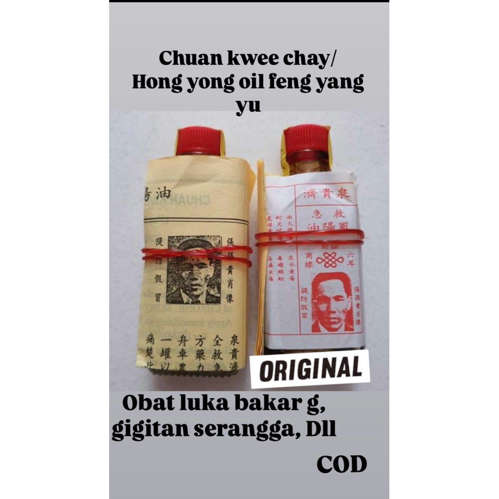 CHUAN KWEE CHAY / HONG YONG OIL FENG YANG YU - LUKA BAKAR - LUKA GIGITAN SERANGGA - OBAT CHINA - OBA