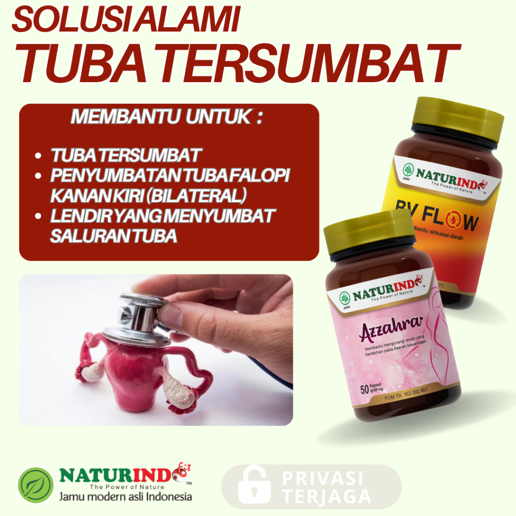 Herbal Tuba Fallopi Tersumbat Penyumbatan Saluran Tuba Fallopi Non-Paten Hidrosalping