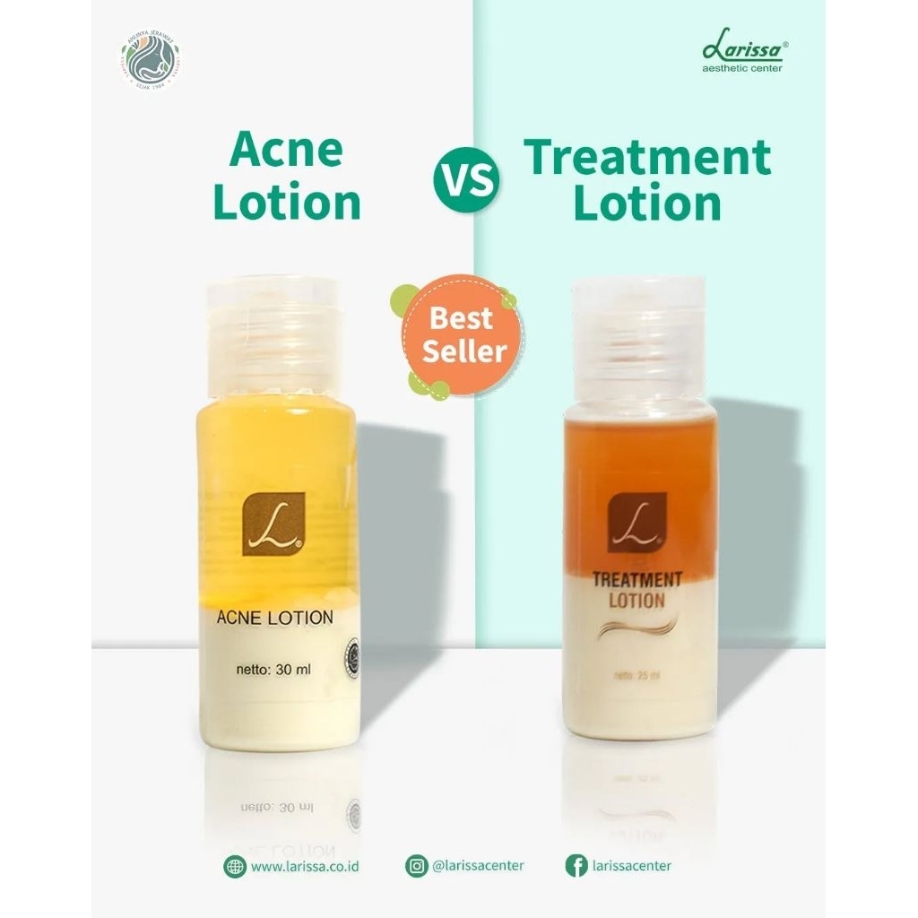 Larissa Acne Lotion - Treatment Lotion Obat Jerawat Ringan / Meradang