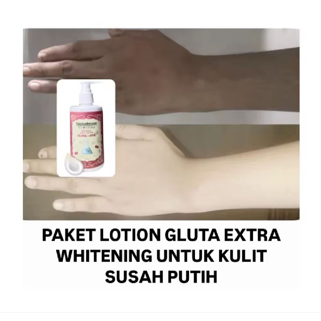 LOTION PENGHILANG BEKAS LUKA DAN PEMUTIH BADAN ELROSSE GLUTA- BODY LOTION MEMUTIHKAN MENGHIKANGKAN B