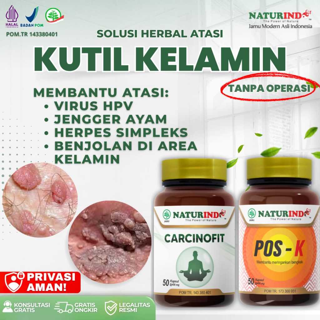Obat Kutil Kelamin Pria Wanita Ampuh Perontok Kutil Kondiloma Jengger Ayam Virus Papiloma HPV Skin T