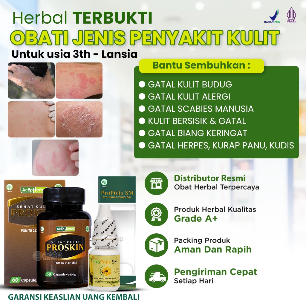 PROSKIN Obat Budug Seluruh Badan Alergi Anak Dewasa Gatal Penghilang Korengan Scabies Manusia Skabie