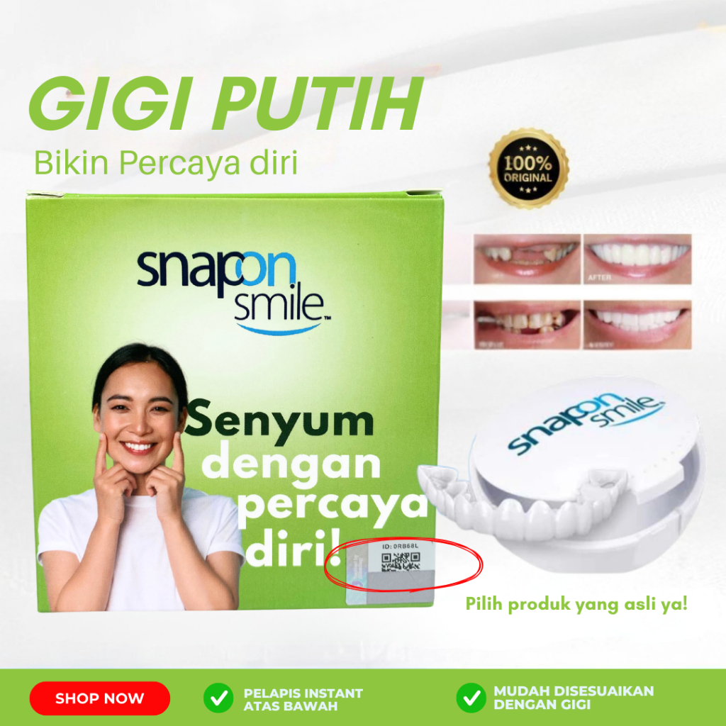 Perapih Gigi Renggang - Perapih Gigi Rata - Perapih Gigi Tidak Rata - Venner Gigi Atas Bawah - Venne