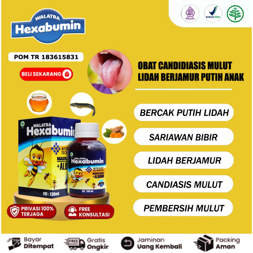 Obat Candidiasis Mulut, Lidah, Jamur Lidah, Mulut Berjamur, Becak Putih Atau   Kuning Di Lidah, Aman