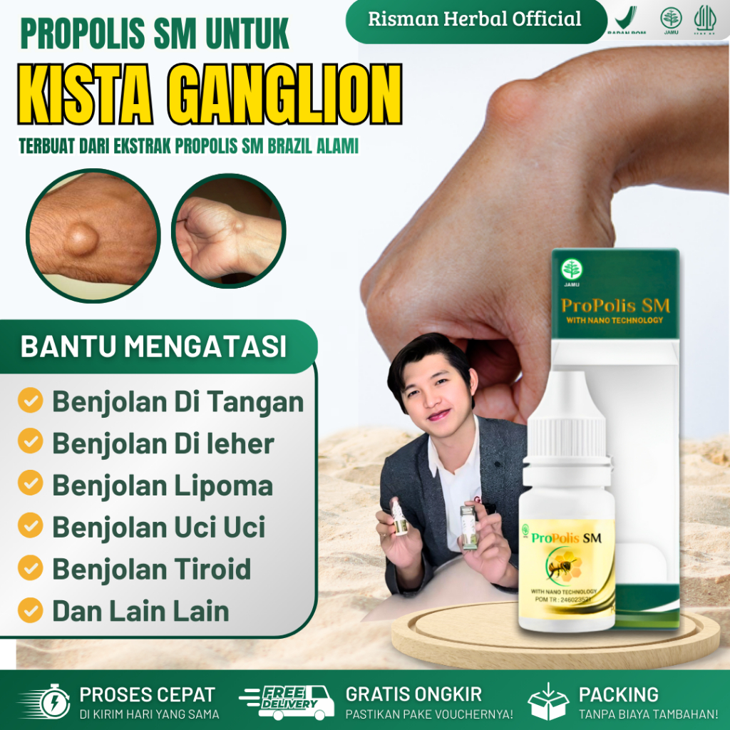 Obat Herbal Oles Benjolan Kista Ganglion Benjolan Di Tangan Di Kaki Di Selangkangan Propolis SM Braz