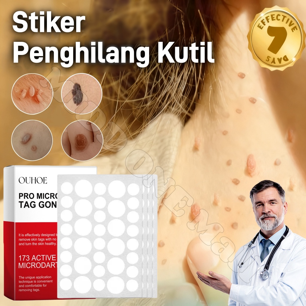 Stiker Penghilang Kutil Dan Tahi Lalat 144pcs Wart Remover Original Penghilang Tahi Lalat Di Wajah L