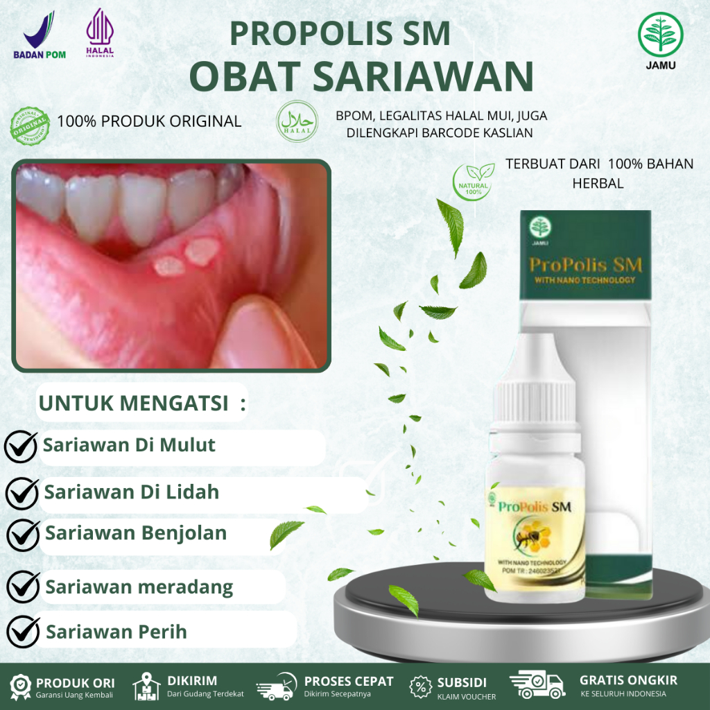 Propolis SM Untuk Sariawan Di Mulut, Sariawan Di Lidah, Sariawan Benjolan, Sariawan Perih, Obat Sari