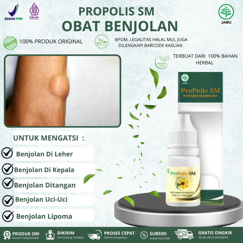 Obat Untuk Mengatasi Benjolan, benjolan Uci-Uci, Benjolan Lipoma, Benjolan Di Tangan, Kaki, Leher Da