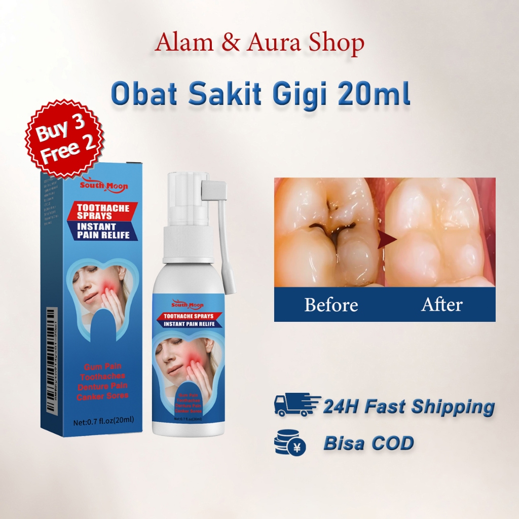 Beli 3 Gratis 2 South Moon Toothache Spray Obat Sakit Gigi 20ml Semprotan sakit gigi Obat Sakit Gigi