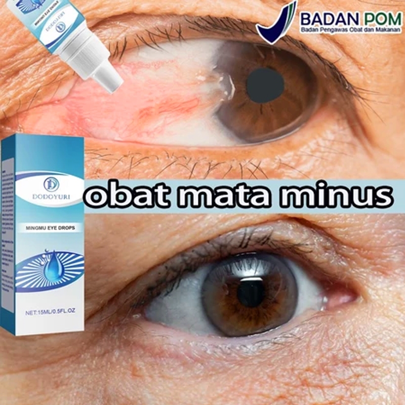 Obat mata katarak Obat mata minus Obat tetes mata Tetes mata 15ml Obat mata Obat katarak Obat tetes 