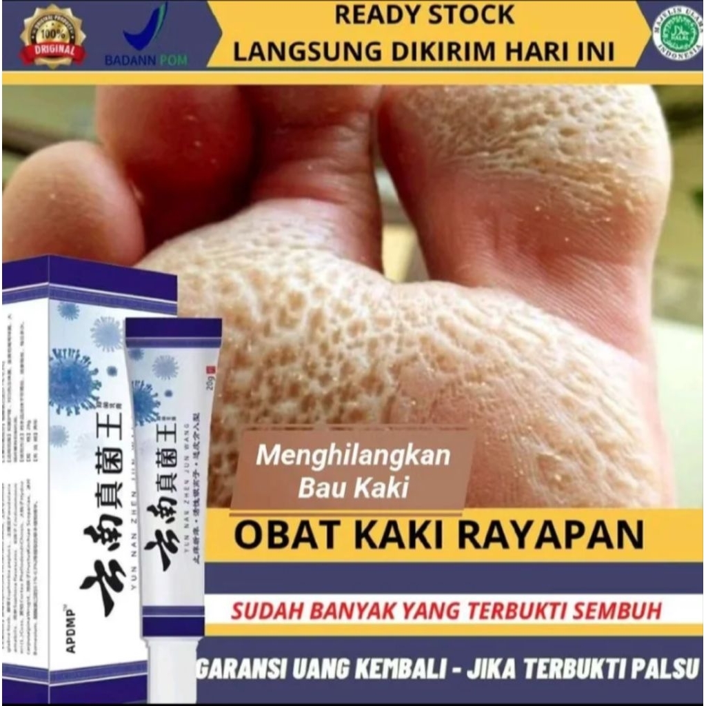 Salep Gatal Kaki Herbal 20g - Mengatasi Jamur, Bau Kaki, dan Gatal