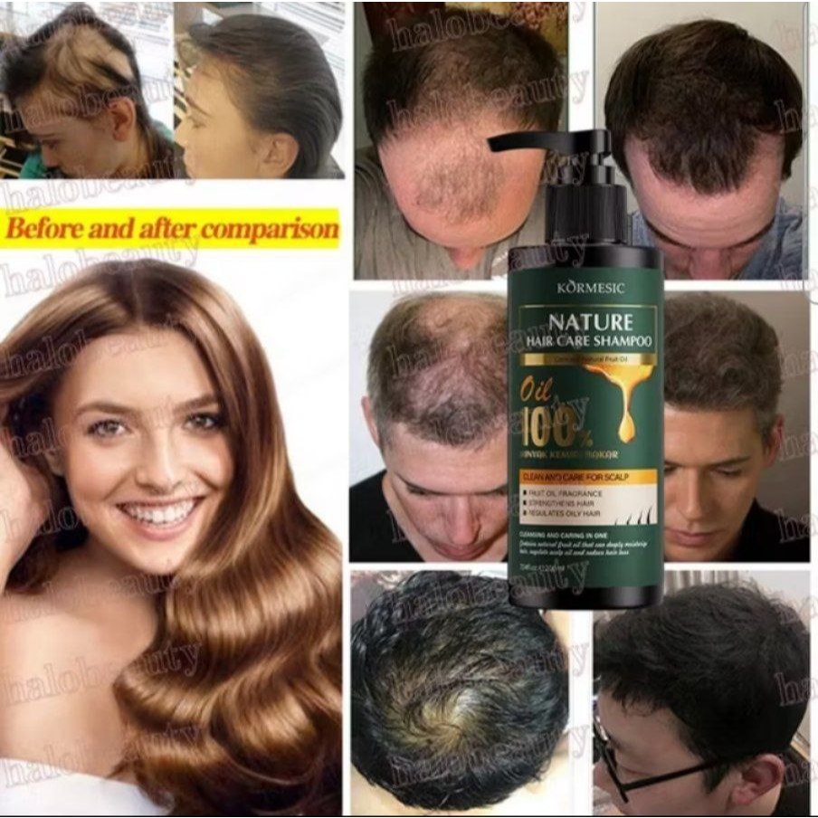Shampoo Kemiri Bakar Penumbuh Rambut Rontok Shampo Anak Anti Ketombe Hair Treatment