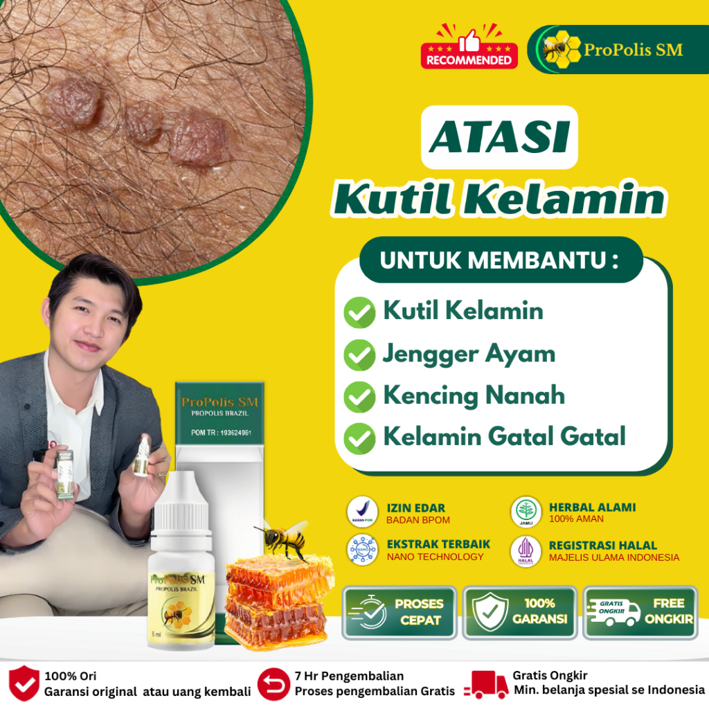 Propolis Sm Obat Kutil Kelamin Pria dan Wanita Kutil Di Anus Gatal Penis Bentol Bintik Merah Ruam Ku