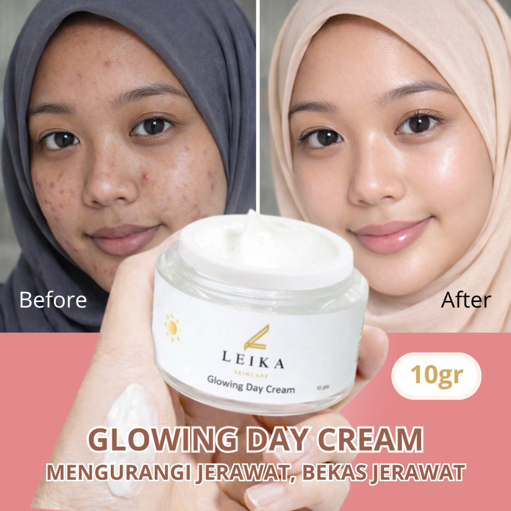 Krim Jerawat dan Bekas Jerawat AMPUH - Leika Skincare Cream Penghilang Jerawat Krim Jerawat Pria Cre