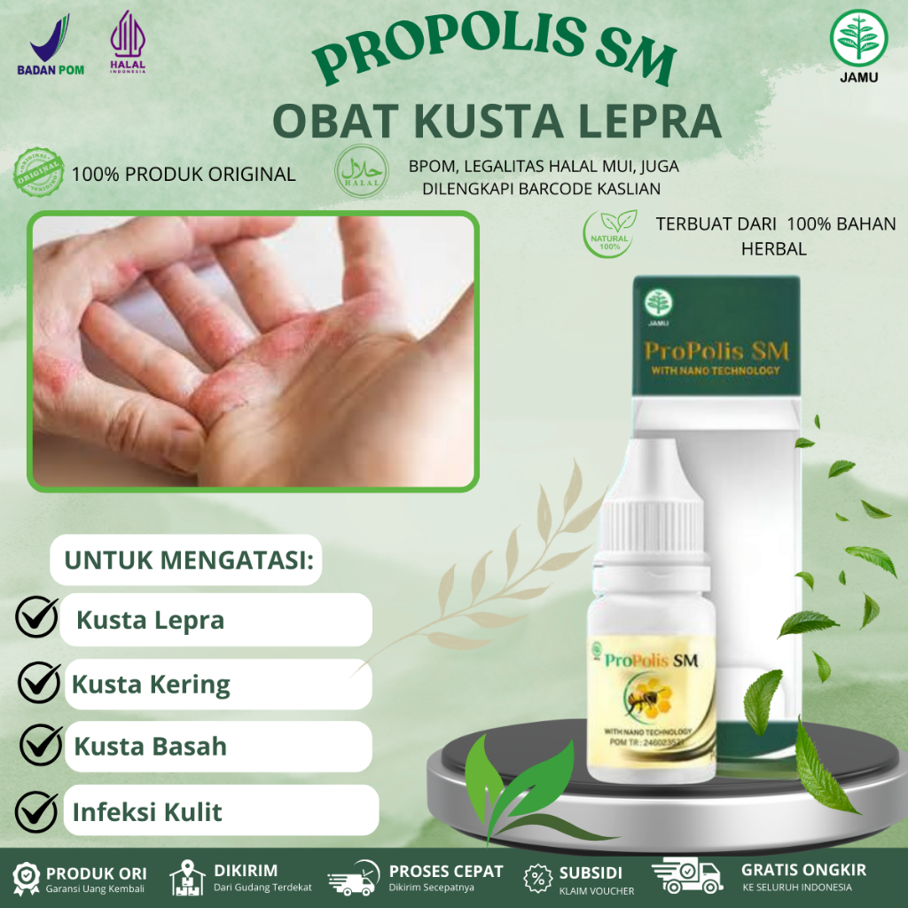 Propolis SM Untuk Kusta Lepra, Kusta Kering, Kusta Basah,  Infeksi Kulit, Mati Rasa, Kusta Lepra Gat