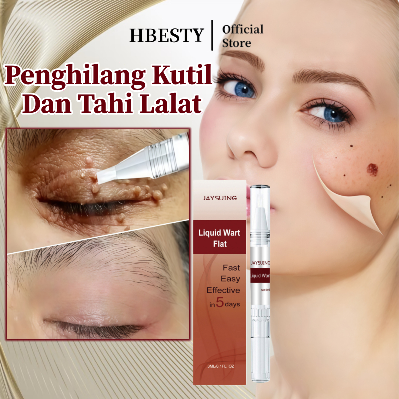 HBESTY Penghilang kutil Penghilang tahi lalat di wajah Penghilang kutil ampuh Kutil dan tahi lalat p