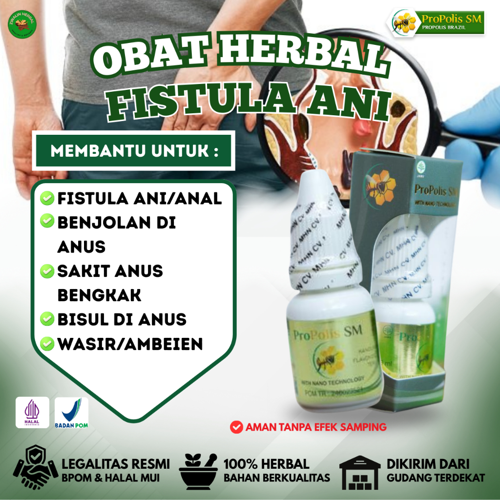 Obat Fistula Ani/Anal, Obat Benjolan Di Anus, Sakit Anus Bengkak, Abses Anus, Bisul Di Anus, Anus Be
