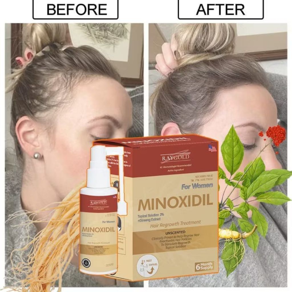 MINOXIDIL 2%for WOMEN penumbuh rambut with Ginseng extract from USA - RAYGOLD - MINOX MINOKSIDIL ant