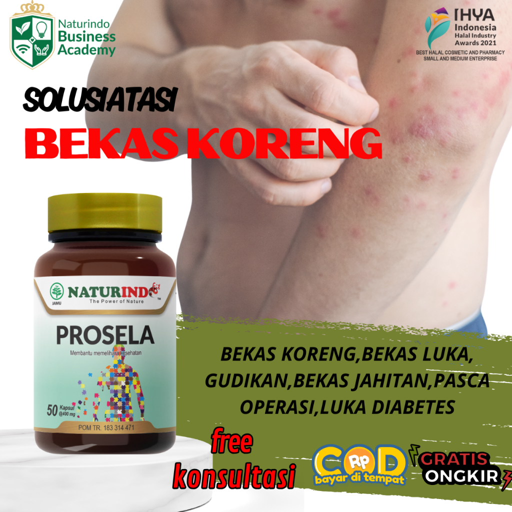 prosela naturindo obat menghilangkan bekas luka, luka koreng,Gatal Cacar Herbal Paling Ampuh Prosela