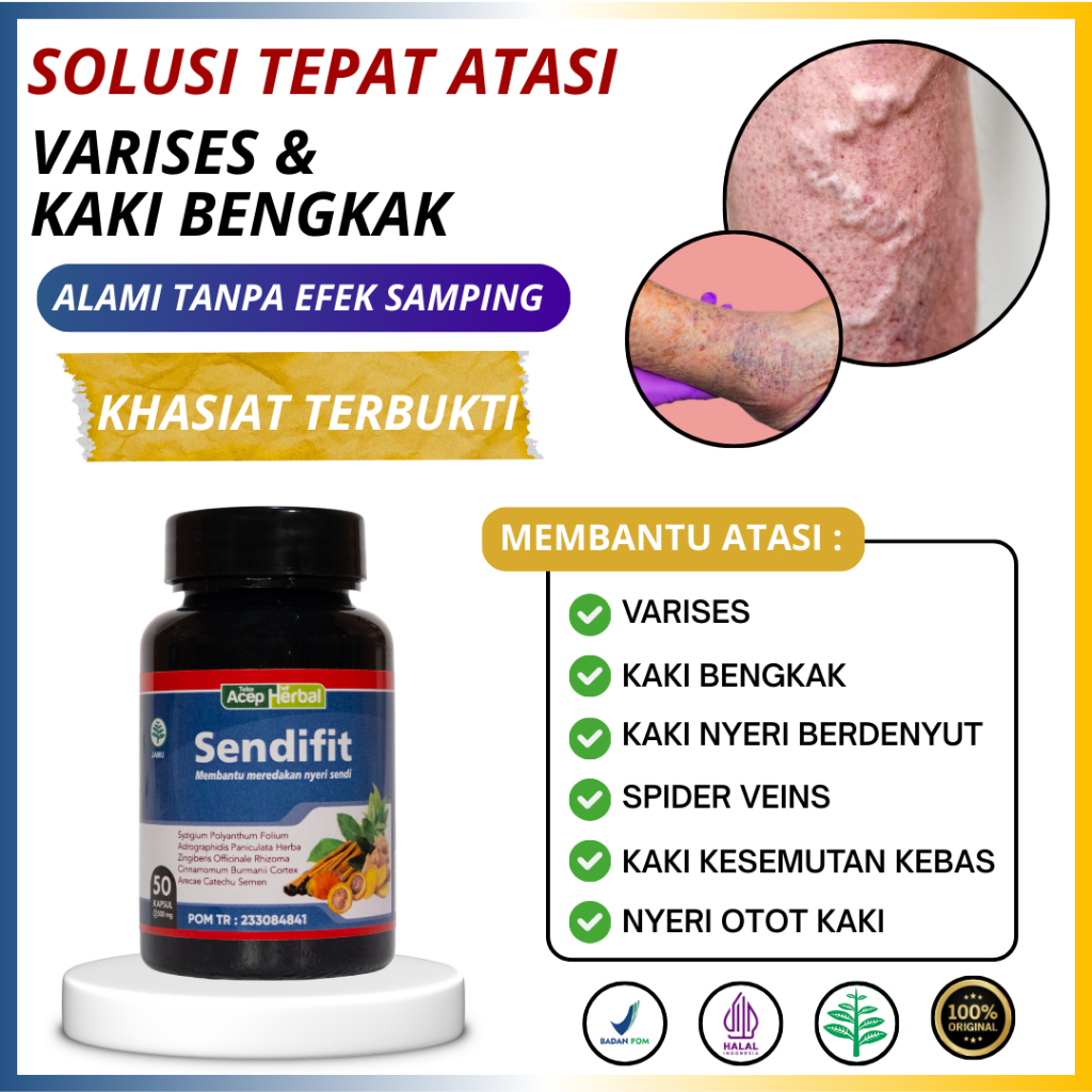 Obat Varises Urat Menonjol Spider Veins Kaki Bengkak Nyeri Otot Berdenyut - Sendifit Kapsul Original