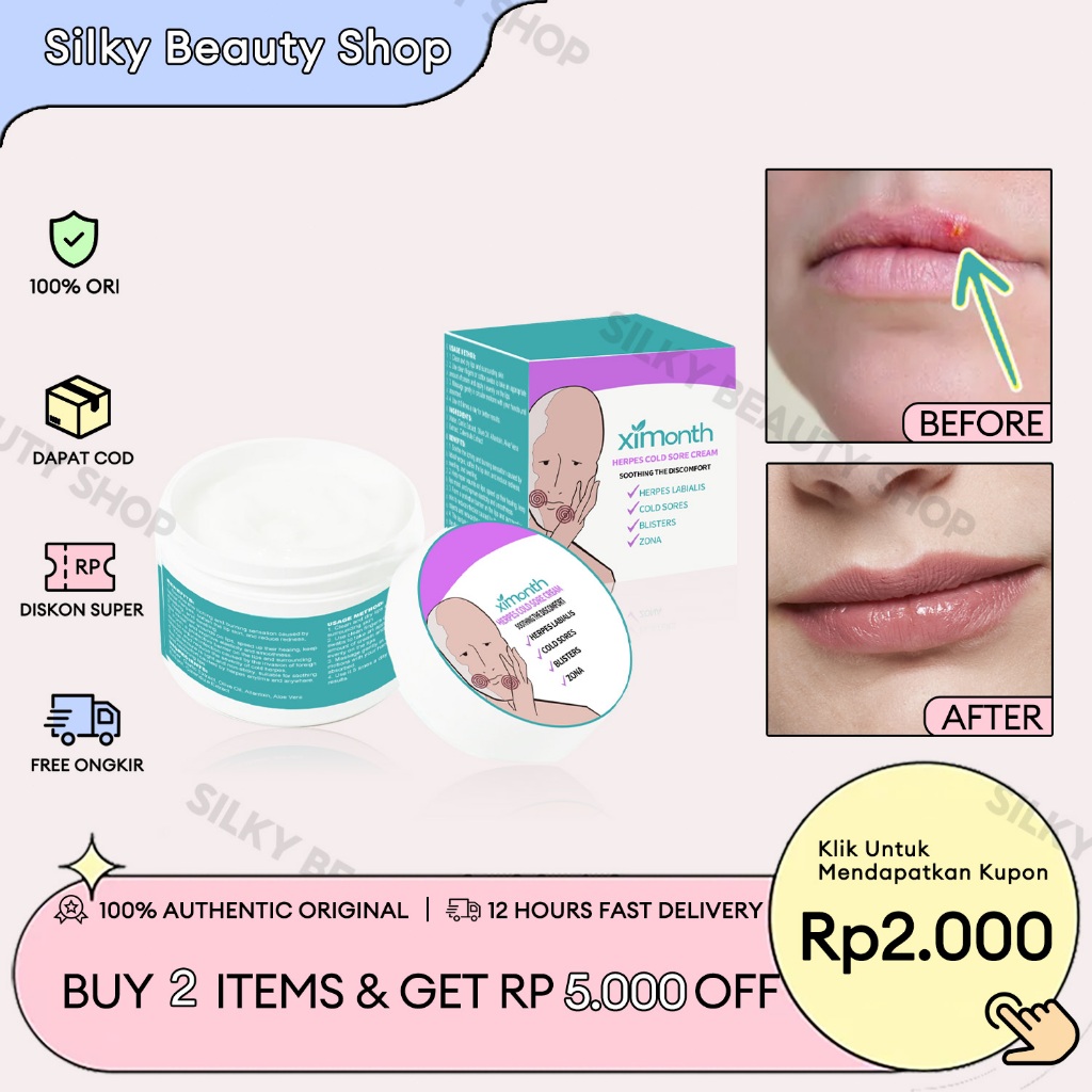 Ximonth Herpes Cold Sore Cream 20g Cheilitis Cream Bibir Peradangan Bibir Herpes Bibir Kering