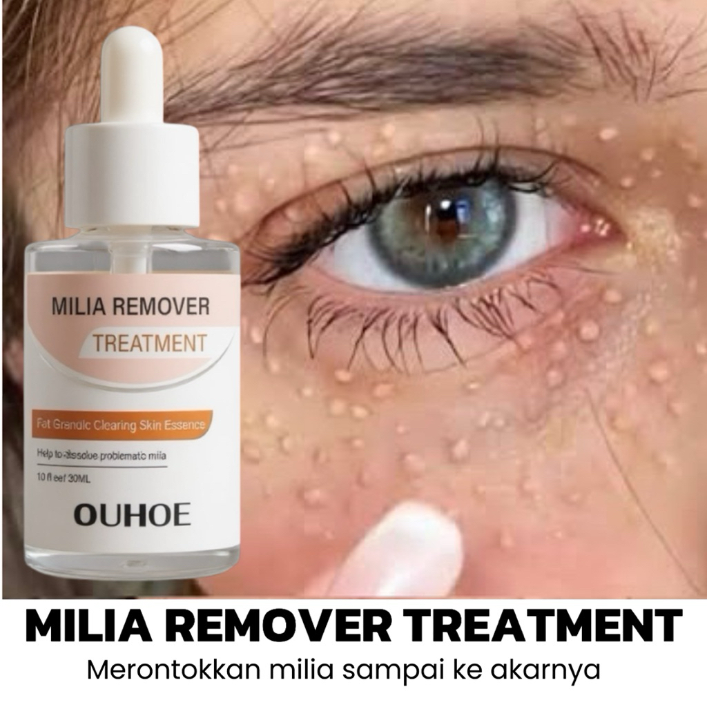 Milia Remover Serum Penghilang Perontok Milia Bintik Putih Mata Ouhoe Milia Remover Treatment Oil-Fr