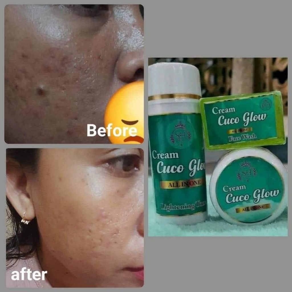 3 paket krim cuco glow by owner SH