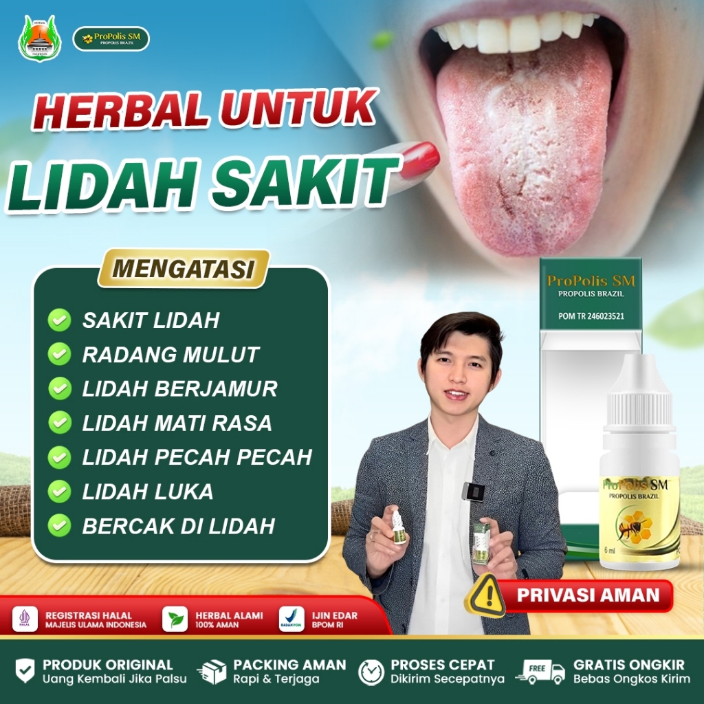 Obat Sakit Lidah, Obat Lidah Putih Berjamur, Obat Lidah Perih, Obat Lidah Pecah Pecah, Obat Lidah Sa