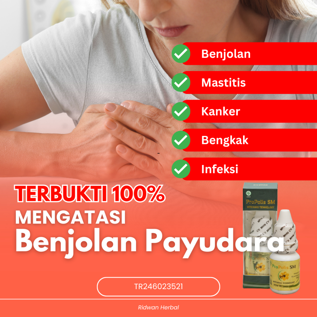 Obat Benjolan Payudara, Obat Bengkak Payudara, Obat Tumor Payudara, Obat Infeksi Payudara, Obat Gata