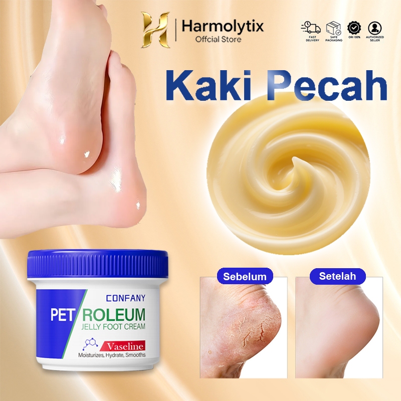 Obat Kaki Pecah Pecah Pelembab Kaki Kering Dan Pecah Krim Tumit Pengelupas Kulit Mati Pecah Pecah
