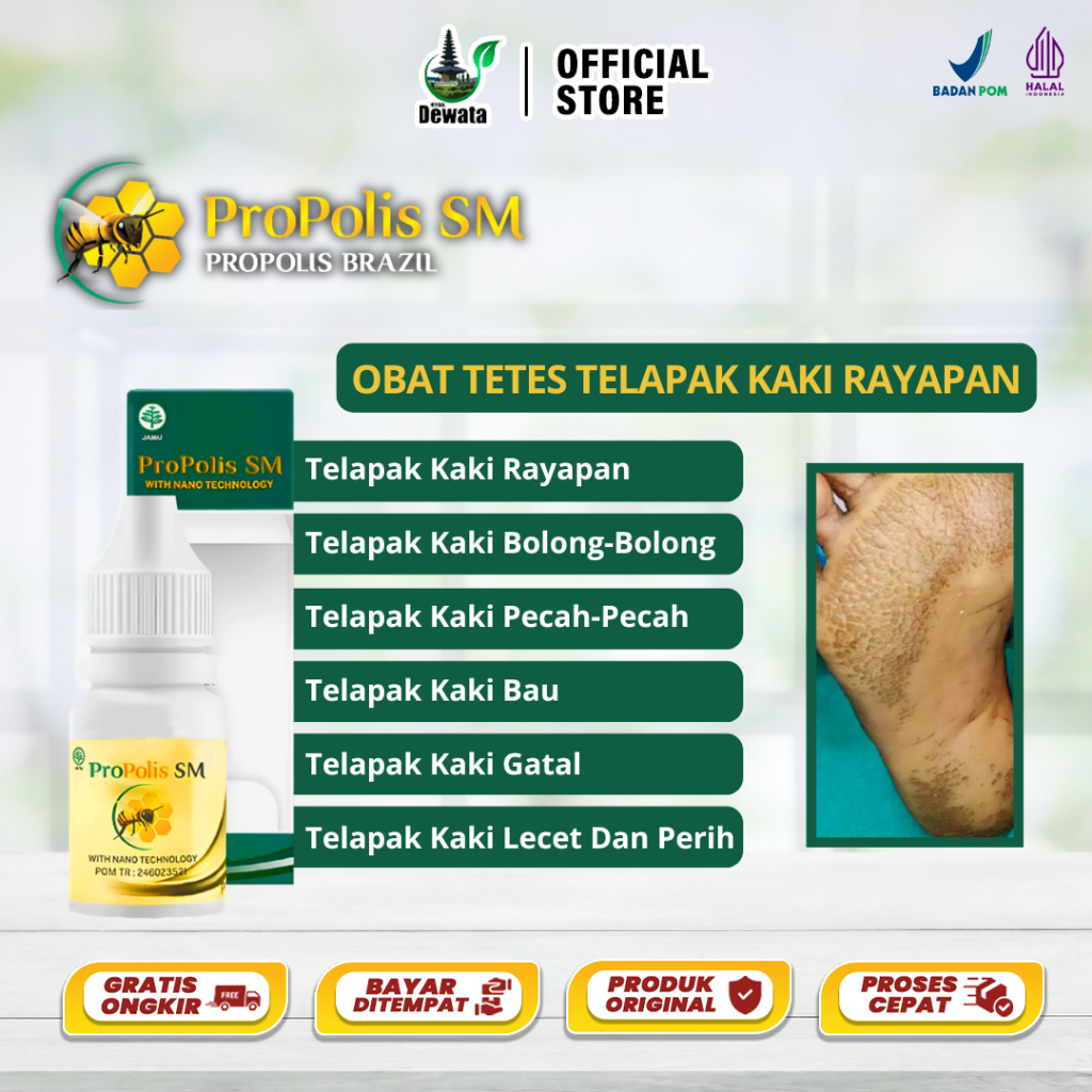Obat Kaki Rayapan, Kaki Pecah2, Kering Parah, Telapak Kaki Rayapan Dan Bau, Salep Buat Tumit Pecah P