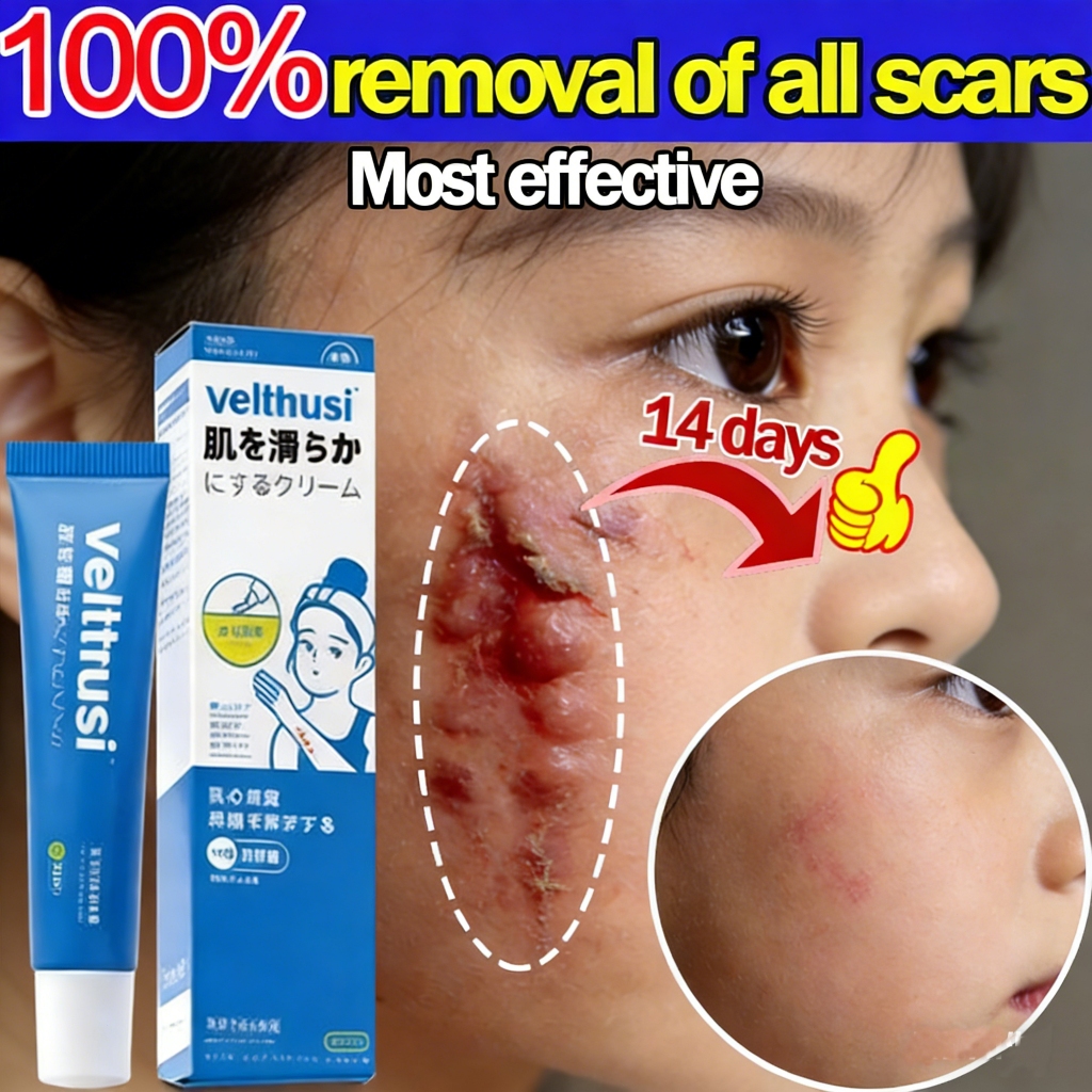 Salep bekas luka penghilang bekas luka Penghilang bekas luka hitam koreng menghilangkan bekas luka o
