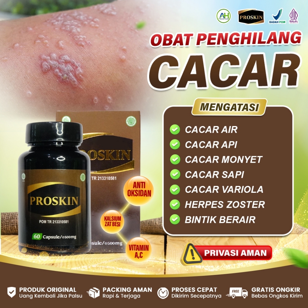 Obat Cacar Air Cepat Kering - Obat Penghilang Bekas Luka Cacar - Obat Cacar Bernanah - Obat Cacar Ap