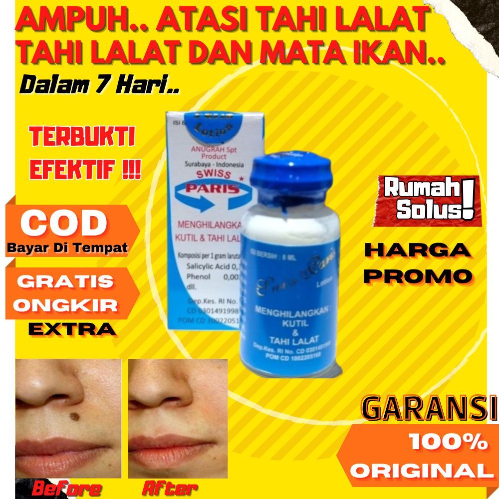 sumifun wart remover Eelhoe Wart Remover 100% Original - Penghilang Kutil Tahi Tai Lalat Mata Ikan A