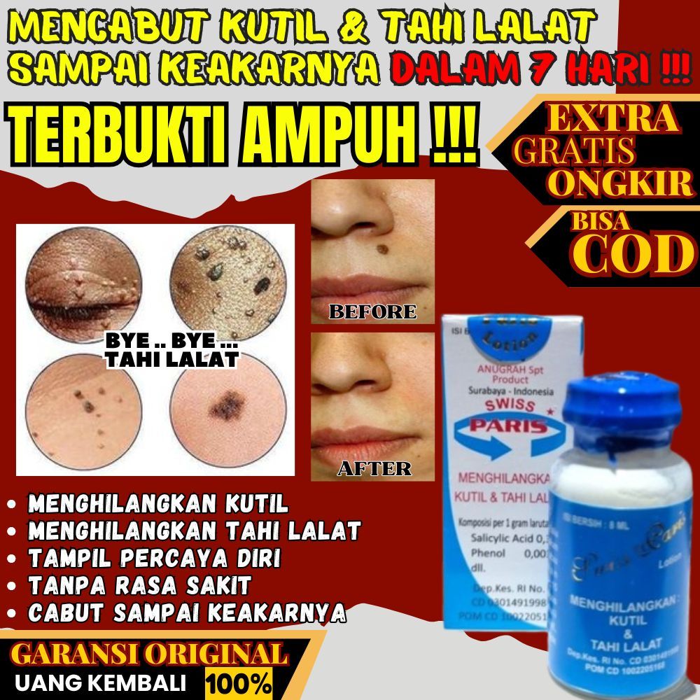 SUMIFUN EELHOE WART REMOVER CREAM PENGHILANG KUTIL DAN TAHI LALAT
