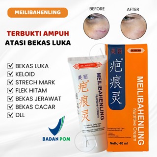 MEILIBAHENLING Penghilang Bekas Luka Cream Penghilang Bekas Luka Ampuh bisa cod