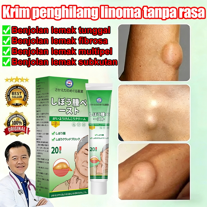 Lipoma Cream 20g Lipoma Removal Cream Benjolan Di Leher Tangan Ketiak Salep Lipoma Penghilang Lemak 