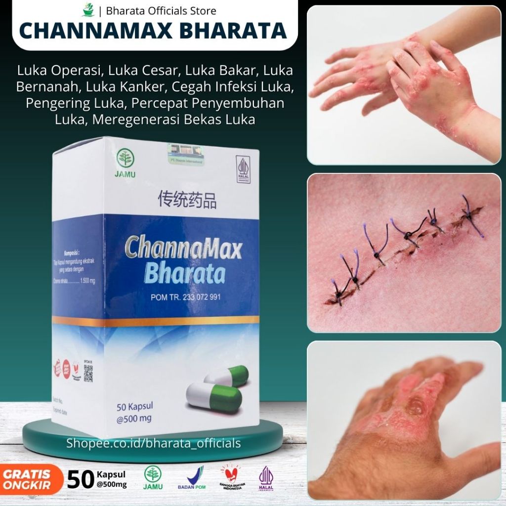 Channamax Bharata Obat Herbal Luka Operasi, Bakar, Diabetes, Infeksi, Caesar Isi 50 Kapsul 100% Asi