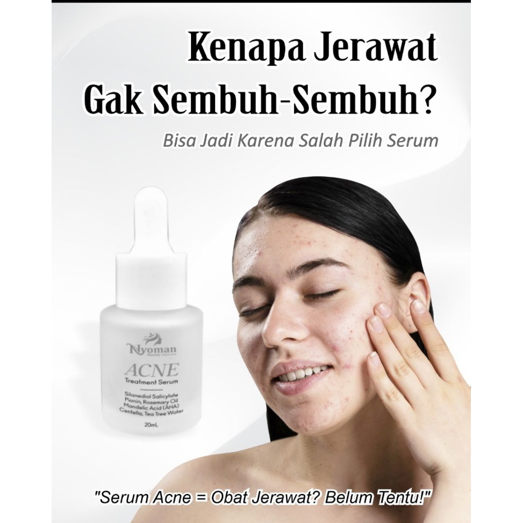 SERUM ACNE NYOMAN SKINCARE