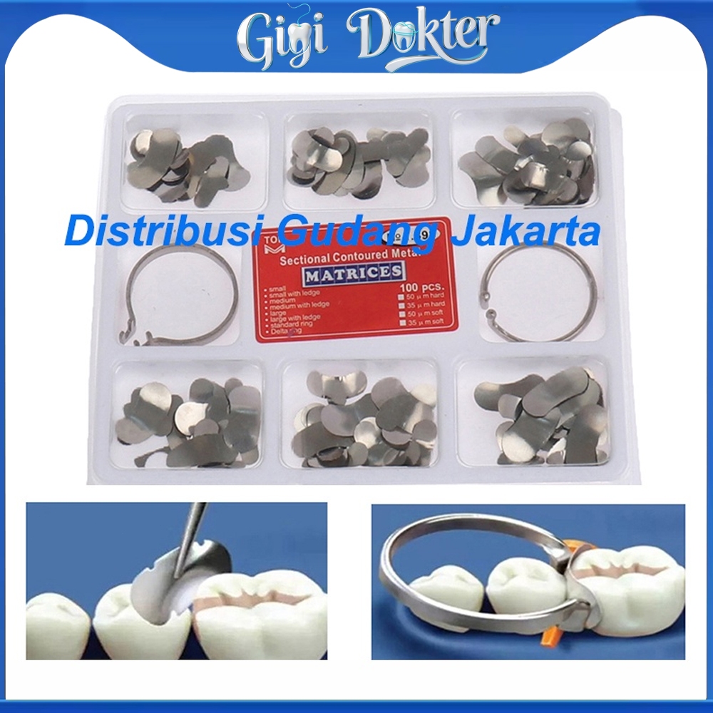 100pcs Dental matrik sectional contoured matrix metal ginjal band gigi universal