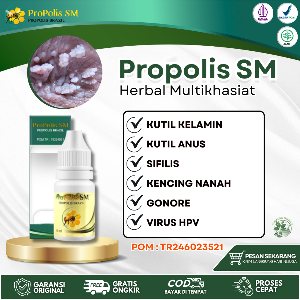 Propolis SM Perontok kutil kelamin Kutil Anus Kutu Jamur Kemaluan Gatal Lecet virus HPV Klamidia Sip